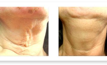 Medicina Estética Dra. Mary Carmen Sánchez Moreno Tratamiento